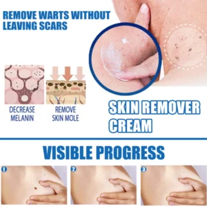 EELHOE™ Clearasil Petechiae Removal Cream