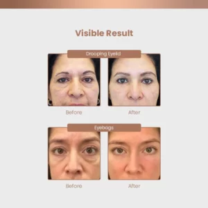 EyeBOOST™ Caffeine Repair & Lifting Eye Cream