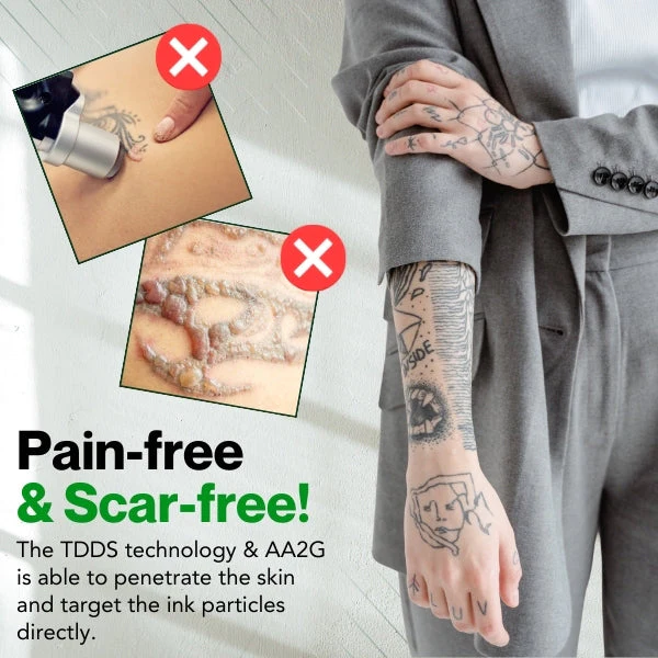 ʻO FadeTech™ Tattoo Removal Serum