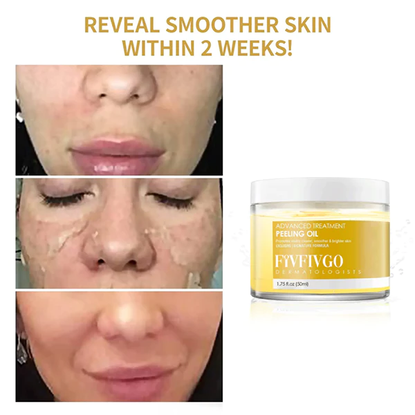 Fivfivgo™ 30 Days Anti-Wrinkle Exfoliate Peeling Oil น้ำมันลอกผิวเพื่อต่อต้านริ้วรอย