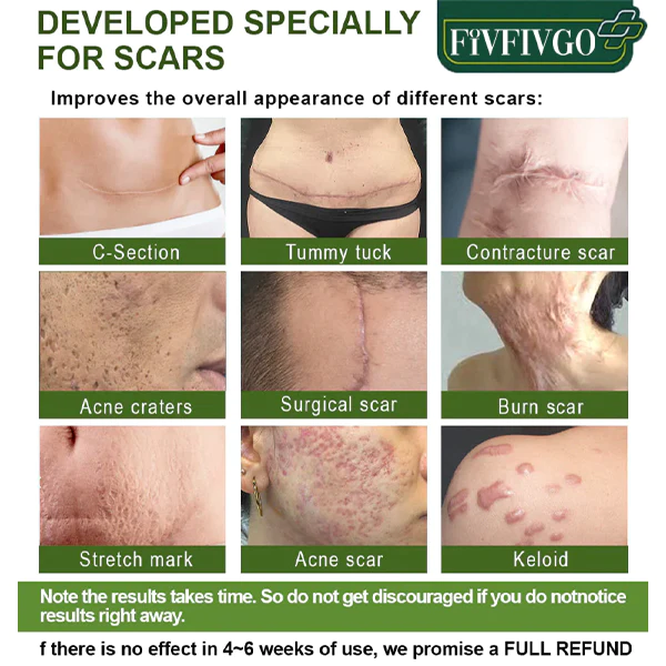 Fivfivgo™ Advanced Scar Repair Serum für All Arten von Narben