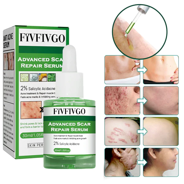 Fivfivgo™ 高级疤痕修复精华液适用于 Arten von Narben