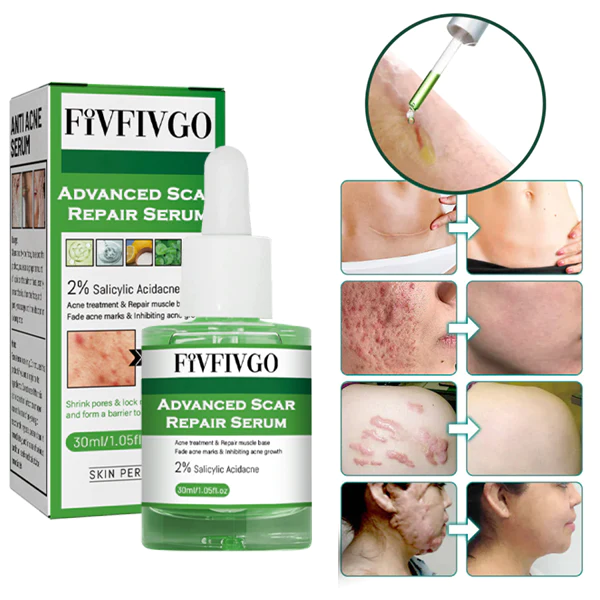 Fivfivgo™ Advanced Scar Repair Serum für alle Arten von Narben
