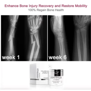 Fivfivgo™ Joint&Bone Haifischknorpel-Stammzellencreme