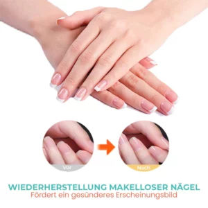 Fivfivgo™ Reichhaltiges Vitamin Nagelstärkendes Nagelhautöl