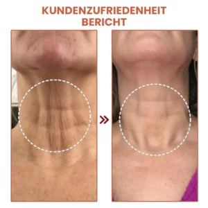 Fivfivgo™ Vita Collagen Bounce Faltenbalsam