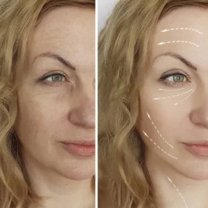 Fivfivgo™ Vita Collagen Bounce Faltenbalsam