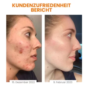 Fivfivgo™ Vitamin C aufhellende Seife