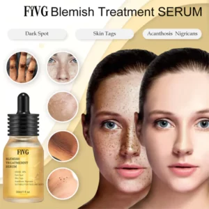 Alternative view of Fivg™ Blemish Treatment Serum