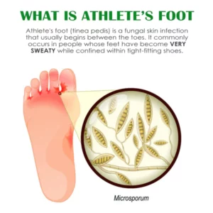 FreshFeet Debacteria Botanical Spray