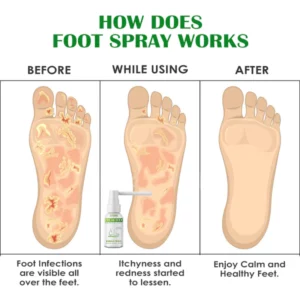 FreshFeet Debacteria Botanical Spray
