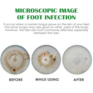 FreshFeet Debacteria Botanical Spray