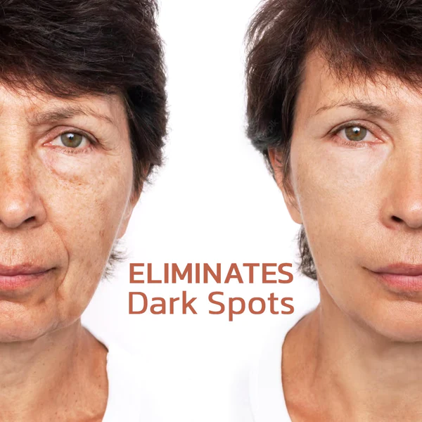 GFOUK ™ Pigmentfreies Behandlungs-Gesichtsserum