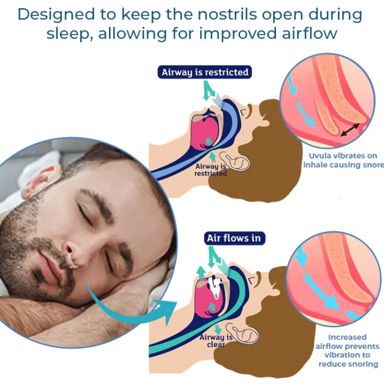 GFOUK™ 睡眠時無呼吸防止ノーズクリップ