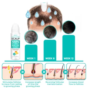 GFOUK™ CooldownScalp Eczema Treatment Roller