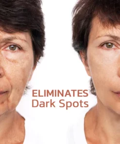 GFOUK™ Pigmentless Treatment Facial Serum