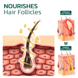 Alternative view of GFOUK™ Scalp Folliculitis Therapy Oil