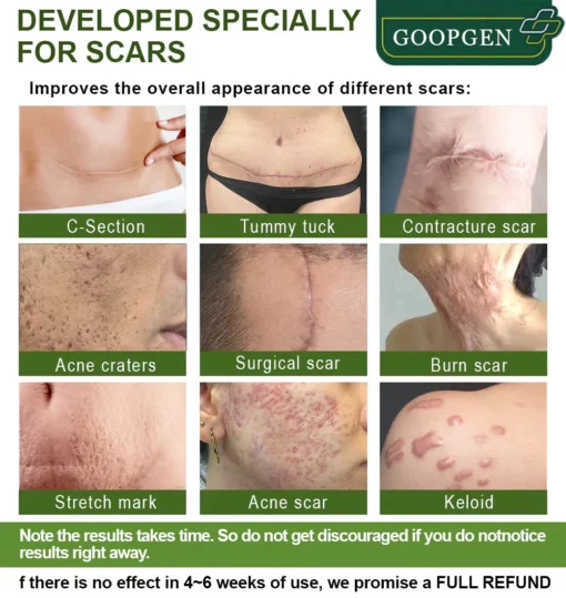 GOOPGEN™ Advanced Scar Repair Serum