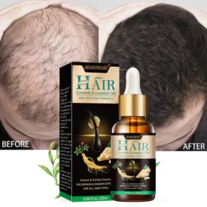 GrowGain™ Ginger Hair Growth Serum