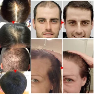 GrowGain™ Ginger Hair Growth Serum