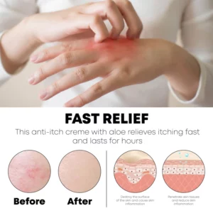 Gutdp™ AntiBacterial Reduce Itchiness Cream