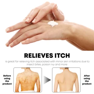 Gutdp™ AntiBacterial Reduce Itchiness Cream