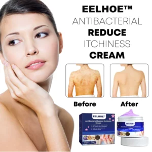 Gutdp™ AntiBacterial Reduce Itchiness Cream