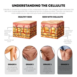Gutdp™ BodySlim Tightening Gel