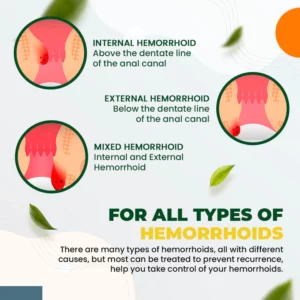 Gutdp™ Hemorrhoid Relief Cream