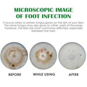 Gutp FreshFeet Debacteria Botanical Spray