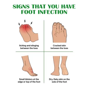Gutp FreshFeet Debacteria Botanical Spray