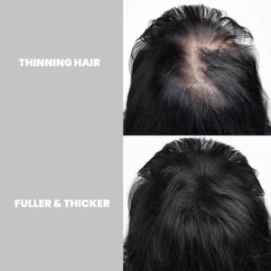 Hair Growth Ginger Cream Treatment