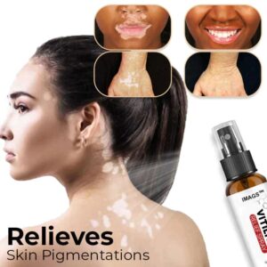 Alternative view of IMAGS™ Vitiligo Relief Spray