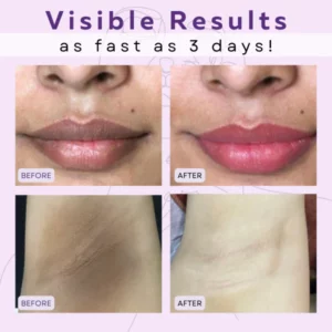Intimate™ Whitening Essence