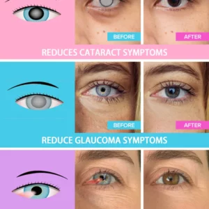 Alternative view of Juenow™ REBRIGHT Natürliche Kräuterdampf-Augenmaske