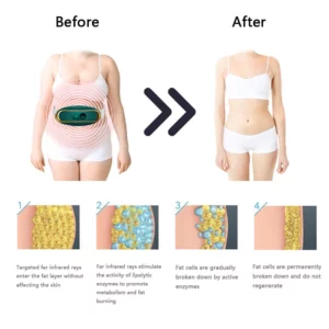 KTMAC™Far Infrared Fat Burning Waist Belt