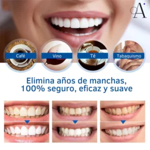 Alternative view of Lanthome™ Esencia blanqueadora de dientes