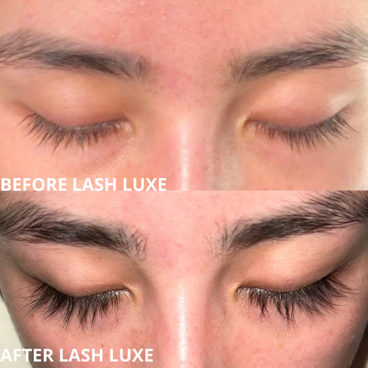 Lashiology ™ Eyelash Growth Serum