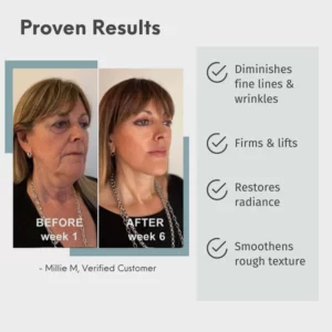 Alternative view of Loqam® Luxury Hyaluronic Acid Anti-Aging Serum