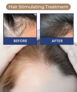 MEDix™ Hair Stimulating Spray