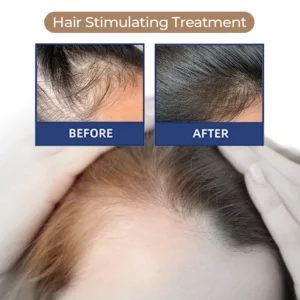MEDix™ Hair Stimulating Spray