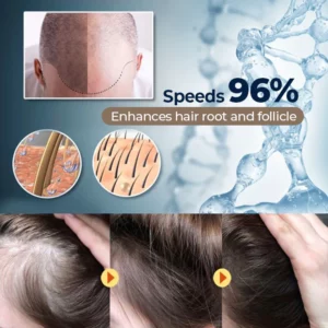 MEDix™ Hair Stimulating Spray
