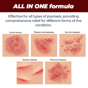 MEDix™ Psoriasis Therapy Spray