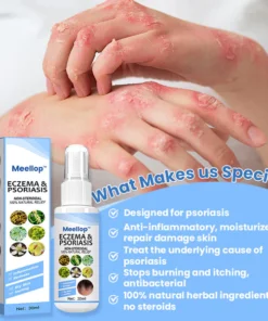 Meellop™ Herbal Psoriasis Relief Spray