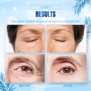 NMN Youth Lifting Anti-Wrinkle Eye Cream