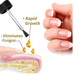 NailGroTM Intense Nail Growth and Strengthening Serum