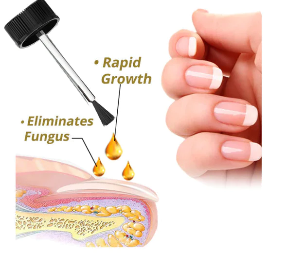 NailGroTM Serum voor intense nagelgroei en versterking