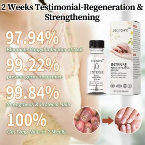 Alternative view of NailGro™ Intense Nail Growth and Strengthening Serum