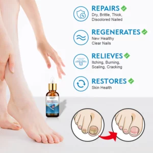 NailX™ Toenail Fungus Care Gel Extra Strength