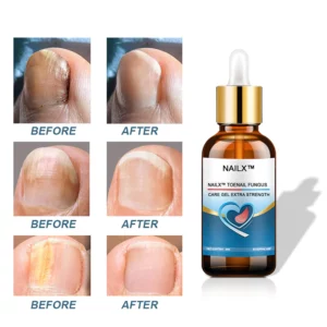 NailX™ Toenail Fungus Care Gel Extra Strength